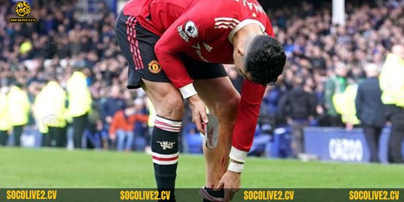 Rote tuy có ưu điểm lớn nhưng cũng có một vài điểm hạn chế nhất định